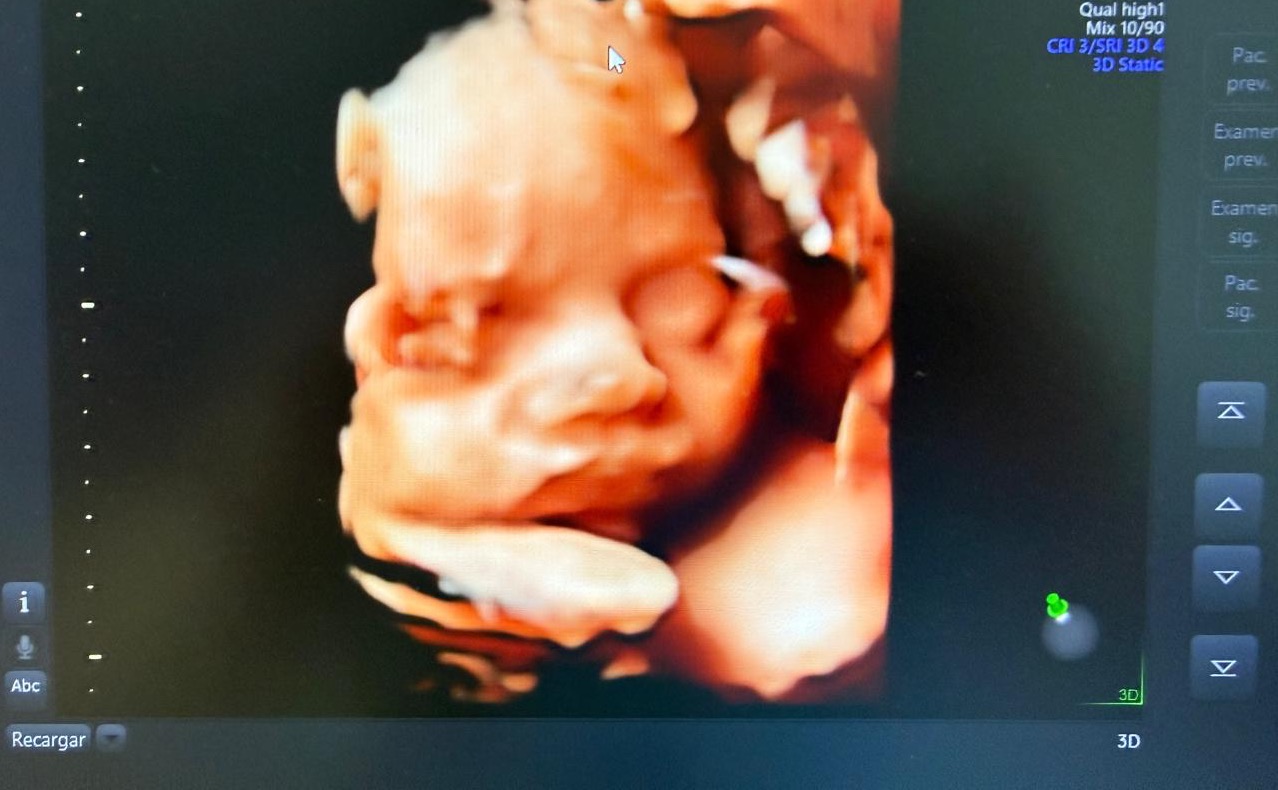 Detalle del rostro del bebé durante un ultrasonido 4D